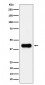 ACAA2 Antibody